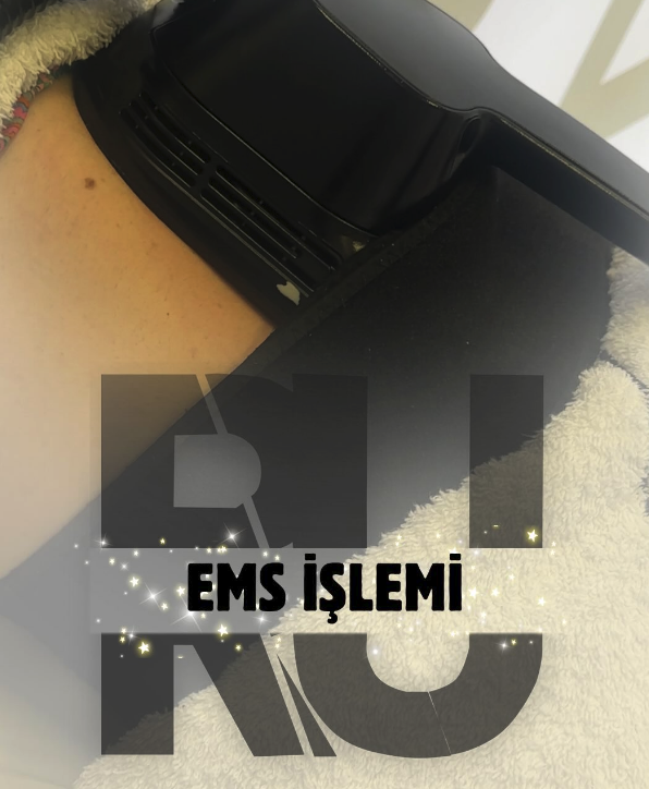 EMS İşlemi